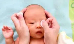 Ketahui Penyebab Mata Bayi Belekan