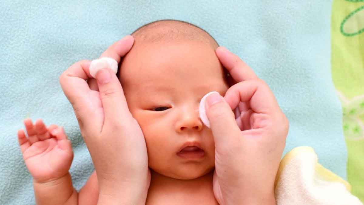 Ketahui Penyebab Mata Bayi Belekan