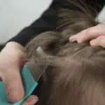 3 Cara Menghilangkan Kutu Rambut yang Bisa Dilakukan di Rumah
