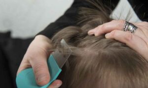 3 Cara Menghilangkan Kutu Rambut yang Bisa Dilakukan di Rumah