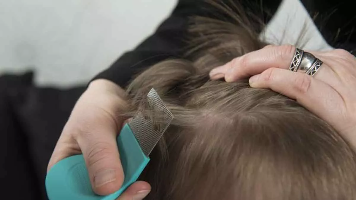 3 Cara Menghilangkan Kutu Rambut yang Bisa Dilakukan di Rumah