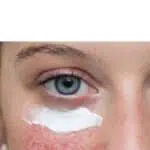 Jangan Sembarangan! Ini 4 Cara Rawat Kulit Sensitif dan Rosacea