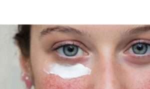 Jangan Sembarangan! Ini 4 Cara Rawat Kulit Sensitif dan Rosacea