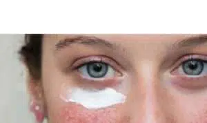 Jangan Sembarangan! Ini 4 Cara Rawat Kulit Sensitif dan Rosacea