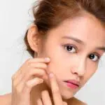 Ini 3 Cara Sederhana Atasi Kulit Beruntusan
