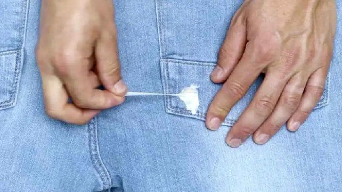 Cara Mudah Hilangkan Noda Bekas Permen Karet di Pakaian