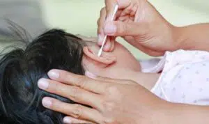 Cara Aman Membersihkan Kotoran Telinga Anak