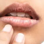 5 Cara Mudah Atasi Bibir Kering dan Pecah-Pecah
