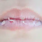 Atasi Bibir Kering dan Pecah-Pecah dengan 4 Cara Berikut