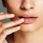 Tak merokok tapi Bibir Berwarna Gelap? Kenali 7 Penyebabnya