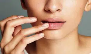 Tak merokok tapi Bibir Berwarna Gelap? Kenali 7 Penyebabnya