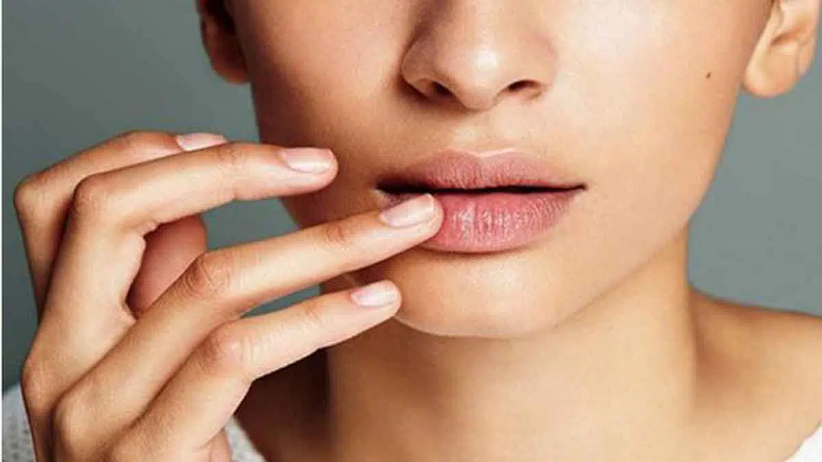 Tak merokok tapi Bibir Berwarna Gelap? Kenali 7 Penyebabnya