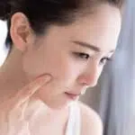 Menurut Ahli Kecantikan, Hindari 6 Bahan Makeup Ini Bagi Wajah Berjerawat