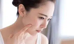 Menurut Ahli Kecantikan, Hindari 6 Bahan Makeup Ini Bagi Wajah Berjerawat