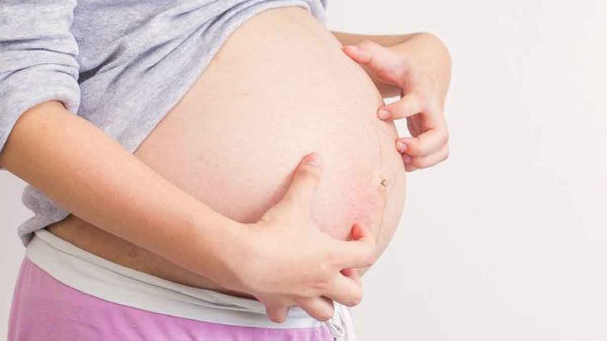 Cara Ampuh Atasi Gatal-gatal Saat Hamil