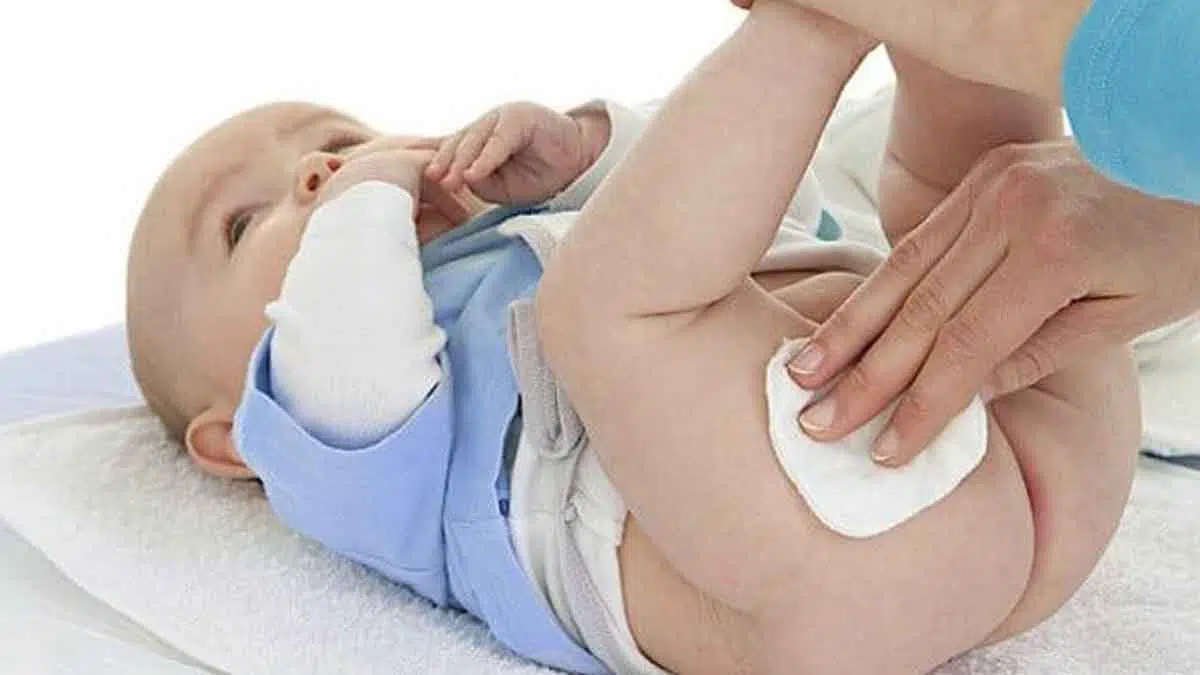 Wajib Anda Ketahui, Penyebab Ruam Popok Sampai Iritasi pada Si Kecil