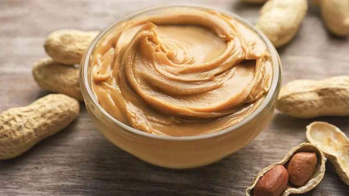 5 Fakta Alergi Kacang yang Perlu Anda Ketahui