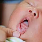 Bunda, Kenali Tanda-Tanda Tumbuh Gigi pada Bayi