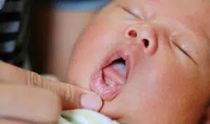 Bunda, Kenali Tanda-Tanda Tumbuh Gigi pada Bayi
