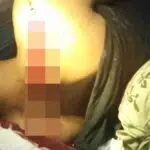 Pelaku Tidak Dikenal, Warga Sampang Dibacok Pakai Golok