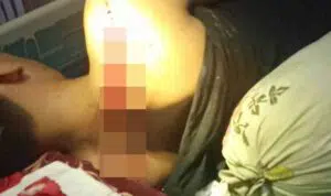 Pelaku Tidak Dikenal, Warga Sampang Dibacok Pakai Golok