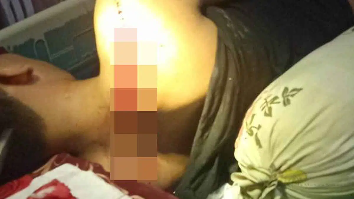 Pelaku Tidak Dikenal, Warga Sampang Dibacok Pakai Golok