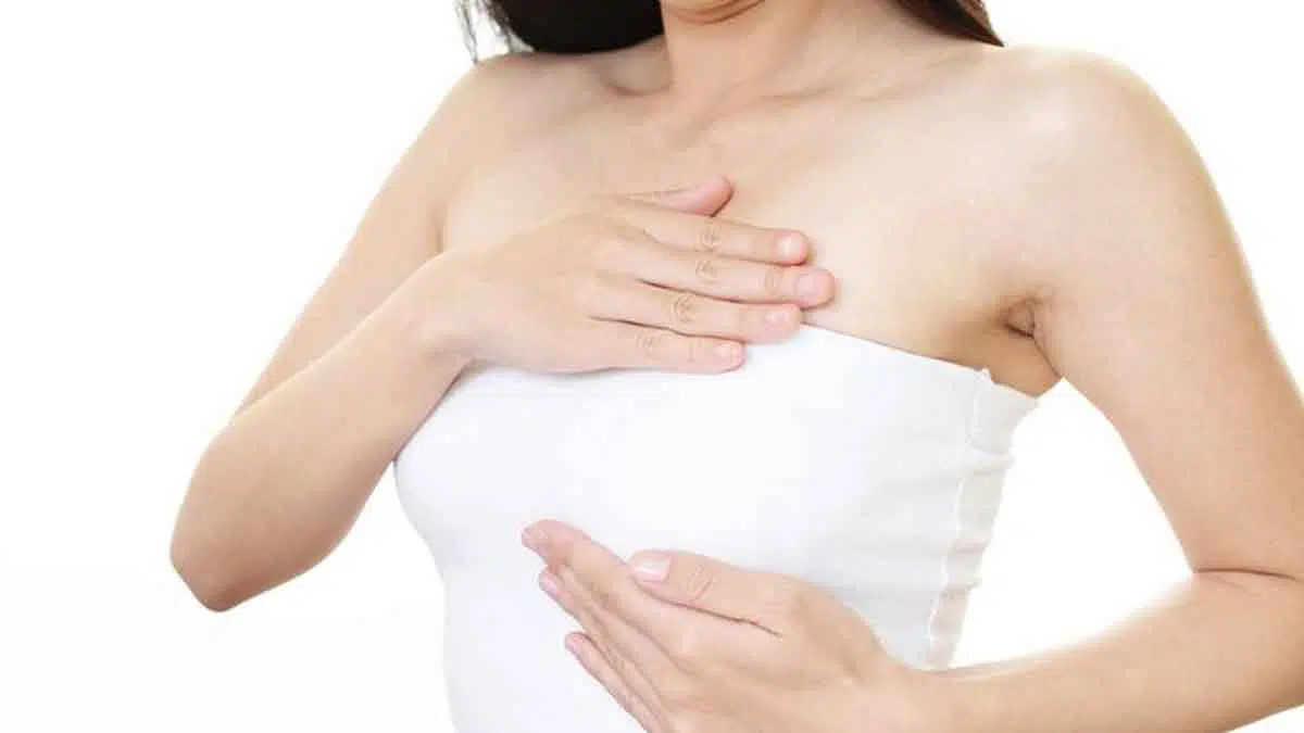 Atasi Stretch Mark di Payudara dengan 6 Cara Ini