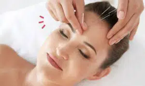 Sederet-Khasiat-Akupuntur-Bagi-Kecantikan-Kulit