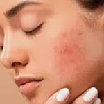 7 Dampak Buruk Cuci Muka dengan Sabun Mandi