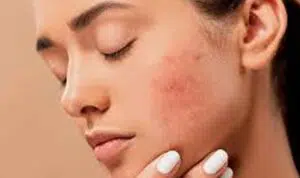 7 Dampak Buruk Cuci Muka dengan Sabun Mandi