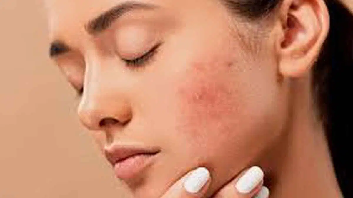 7 Dampak Buruk Cuci Muka dengan Sabun Mandi