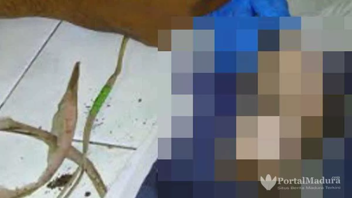 Polisi Sumenep Buru Pelaku Mutilasi Bayi di Masalembu
