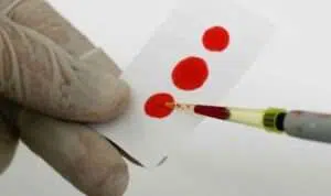 PBB-Sekitar-11.000-Orang-di-Yaman-Hidup-dengan-HIV