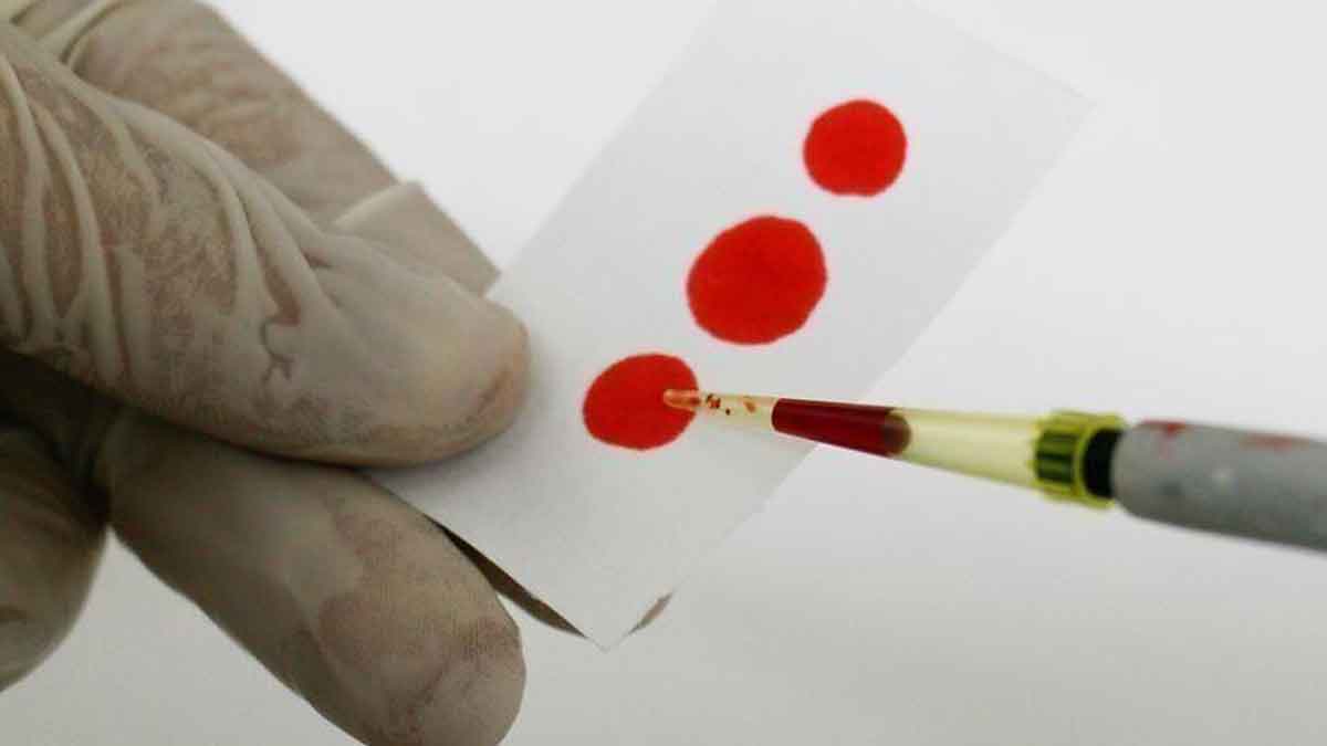 PBB-Sekitar-11.000-Orang-di-Yaman-Hidup-dengan-HIV