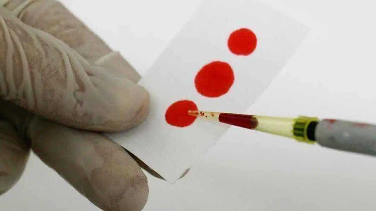 PBB-Sekitar-11.000-Orang-di-Yaman-Hidup-dengan-HIV