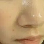 Atasi Kulit Hidung Berminyak dengan 5 Cara Ini