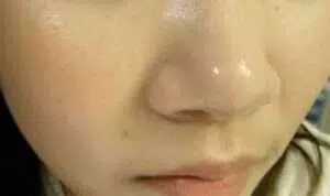 Atasi Kulit Hidung Berminyak dengan 5 Cara Ini