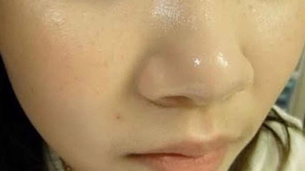 Atasi Kulit Hidung Berminyak dengan 5 Cara Ini