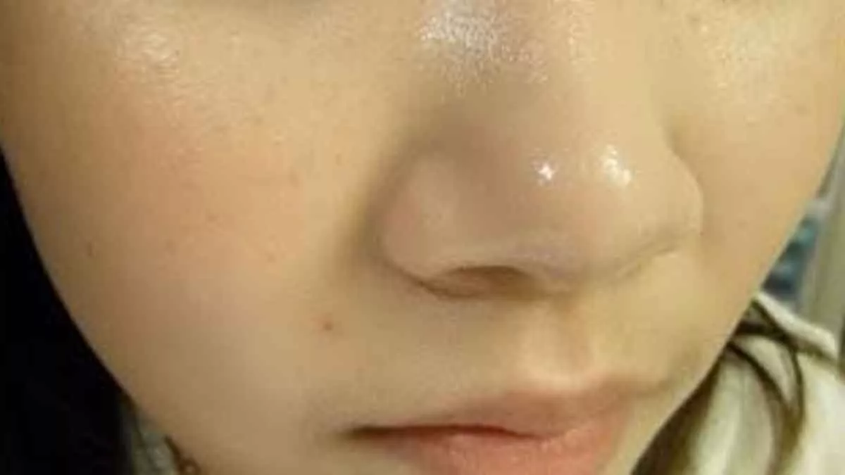 Atasi Kulit Hidung Berminyak dengan 5 Cara Ini