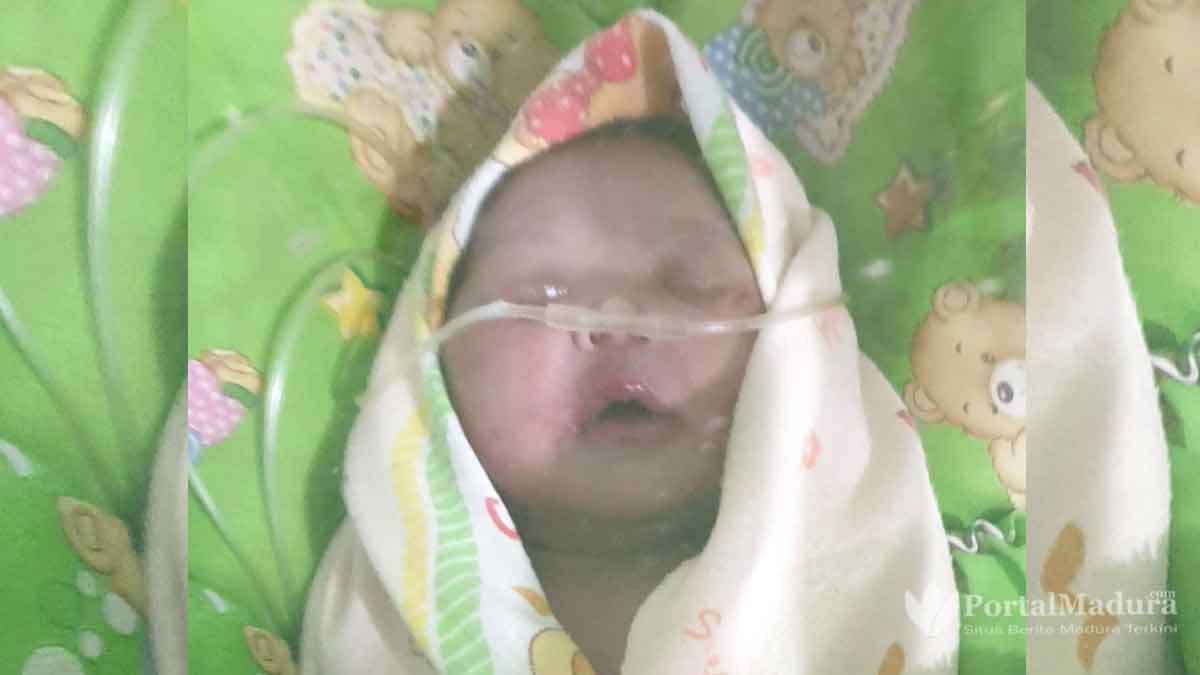 Warga Sumenep Temukan Bayi di Kebun Jati
