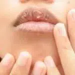 3 Kandungan Pelembap yang Bisa Lindungi Bibir Kering