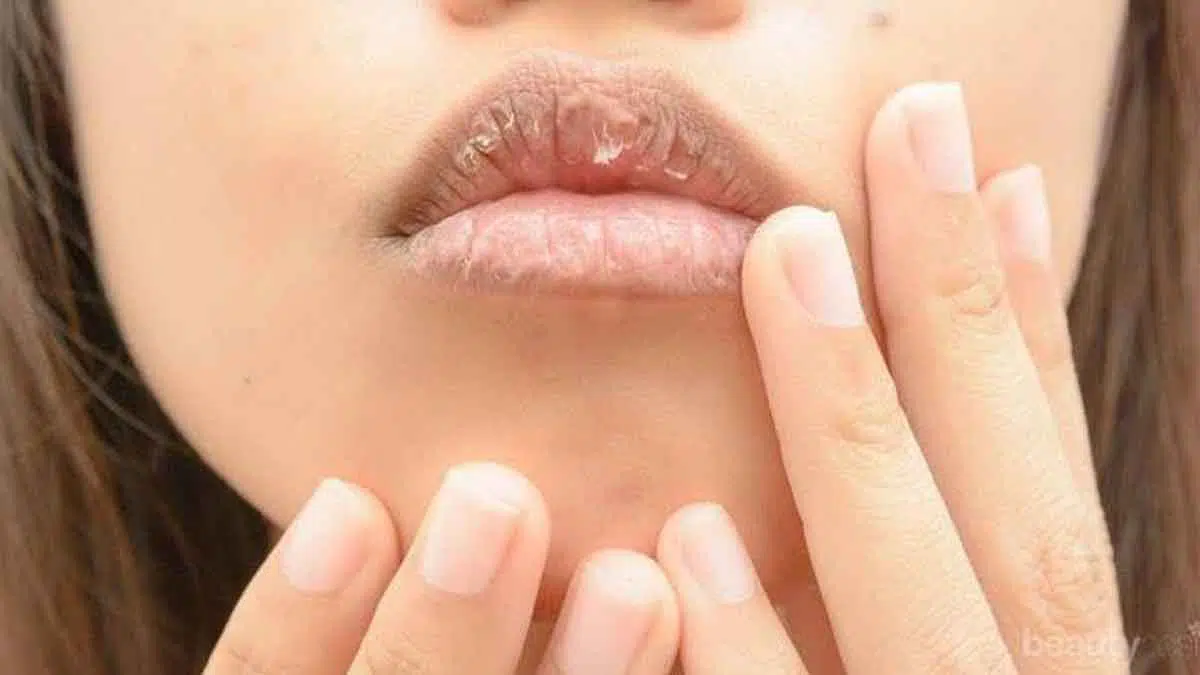 3 Kandungan Pelembap yang Bisa Lindungi Bibir Kering