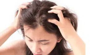 4 Bahan Alami yang Bisa Atasi Gatal di Kulit Kepala