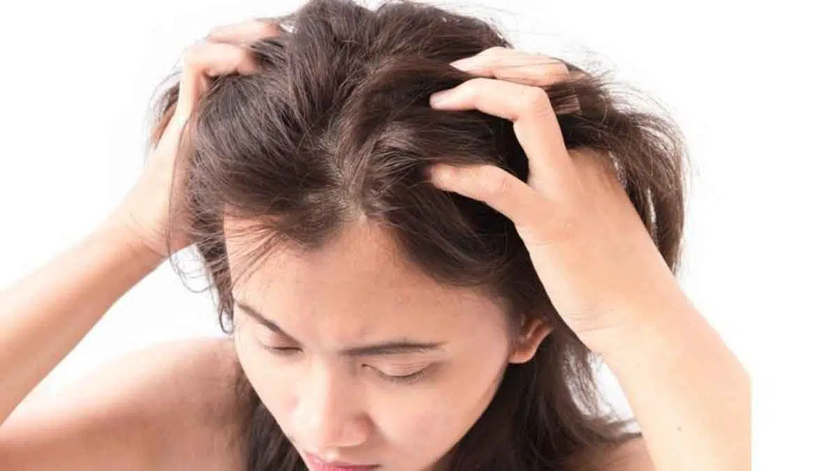 4 Bahan Alami yang Bisa Atasi Gatal di Kulit Kepala