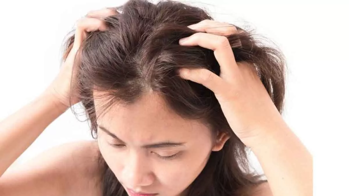 4 Bahan Alami yang Bisa Atasi Gatal di Kulit Kepala