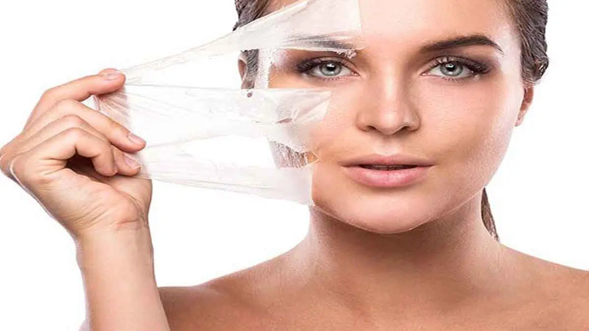 Lakukan 5 Hal Ini Setelah Chemical Peeling