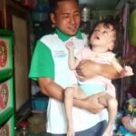 Bocah Keluarga Tak Mampu Menderita Hidrosefalus di Sampang