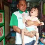 Bocah Keluarga Tak Mampu Menderita Hidrosefalus di Sampang