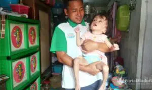 Bocah Keluarga Tak Mampu Menderita Hidrosefalus di Sampang