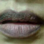 Cegah Bibir Menghitam dengan 5 Cara Ini